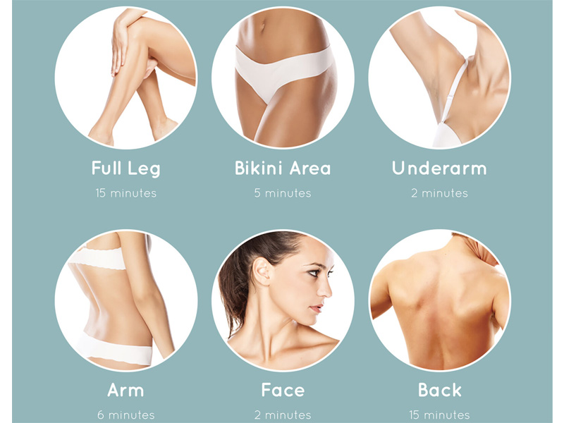 Máy triệt lông HoMedics IPL-HH390BNS-GB