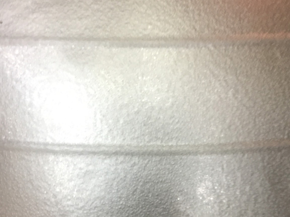 Bóng tập Yoga nửa gai Pro-Care 65cm - NT - 65MG