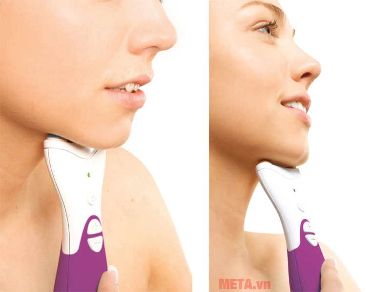 Máy nâng cơ vùng cổ và cằm (chống nọng cằm) NECK4