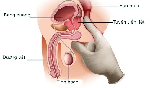 Điểm G của nam giới